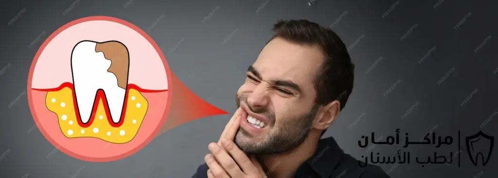 ارخص اسعار زراعة الاسنان في مصر ومعايير اختيار النخبة الطبية وجراحة ضرس العقل